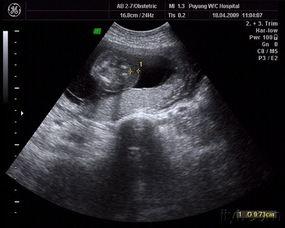 怀孕三个月的图片,初显胎姿，幸福时光悄然来临